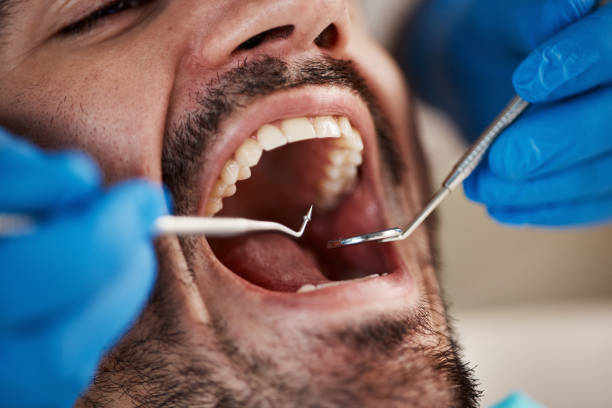 Best Emergency Gum Pain Relief  in Thompsonville, CT